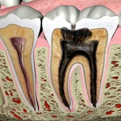 Toothpaste general asset