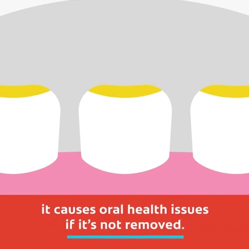 Toothpaste general asset