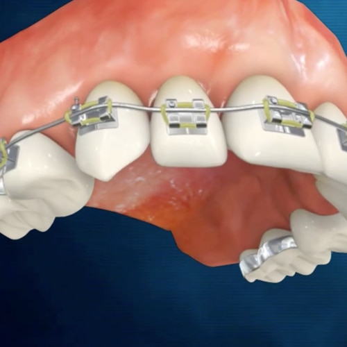 Toothpaste general asset