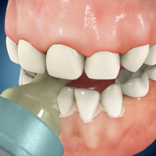 Toothpaste general asset