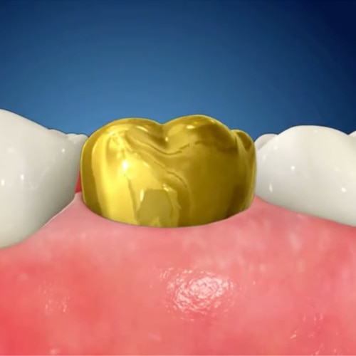 general toothpaste image