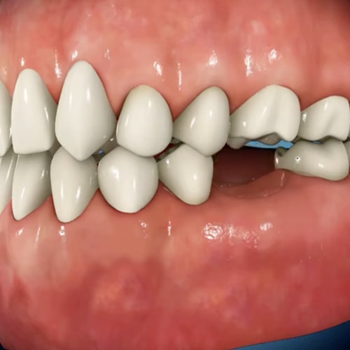 general toothpaste image