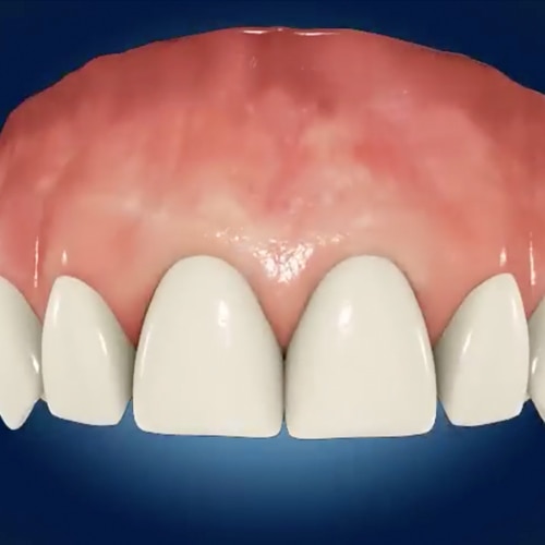 general toothpaste image