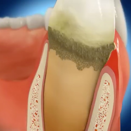 general toothpaste image