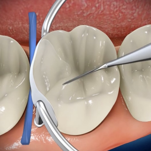 general toothpaste image