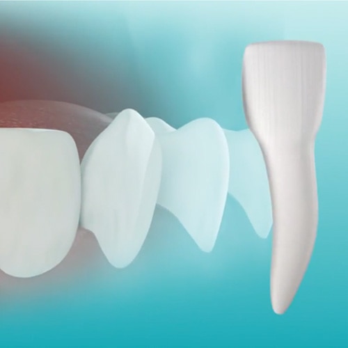 general toothpaste image