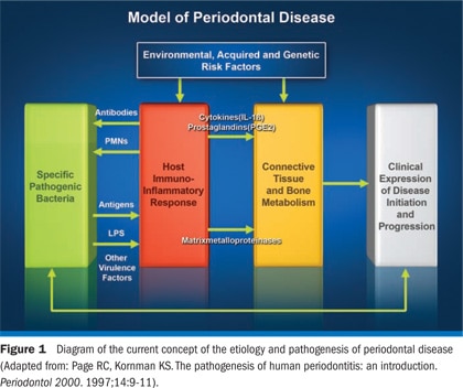 Dental caries and plaque image of teeth