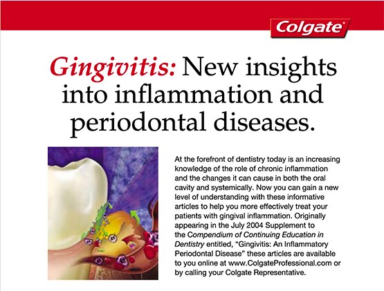 Dental caries and plaque image of teeth