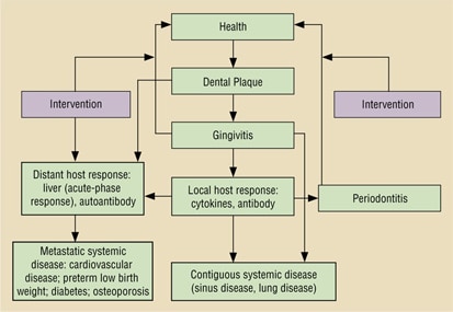Dental caries and plaque image of teeth