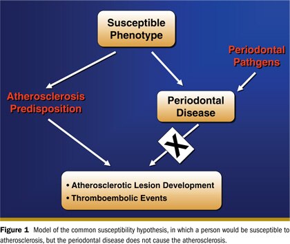 Dental caries and plaque image of teeth