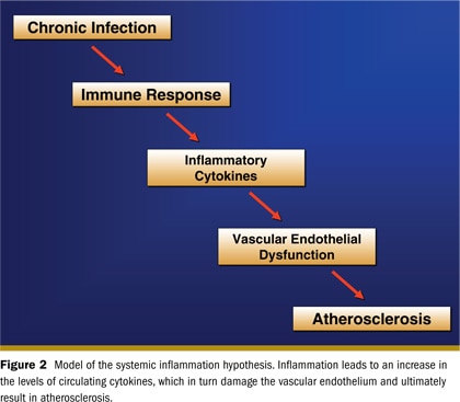Dental caries and plaque image of teeth